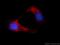 Transient Receptor Potential Cation Channel Subfamily M Member 8 antibody, 12813-1-AP, Proteintech Group, Immunofluorescence image 