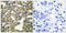 Matrix Metallopeptidase 13 antibody, LS-C118520, Lifespan Biosciences, Immunohistochemistry paraffin image 