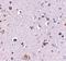 Nucleoporin 160 antibody, LS-C83893, Lifespan Biosciences, Immunohistochemistry paraffin image 