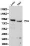 Protein Kinase C Alpha antibody, LS-C192652, Lifespan Biosciences, Western Blot image 