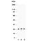 Lymphotoxin Alpha antibody, R30429, NSJ Bioreagents, Western Blot image 