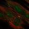 Transmembrane Protein 117 antibody, HPA039899, Atlas Antibodies, Immunofluorescence image 