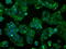 Cytochrome P450 Family 2 Subfamily E Member 1 antibody, GTX84636, GeneTex, Immunofluorescence image 