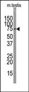 SRY-Box 30 antibody, AP13266PU-N, Origene, Western Blot image 