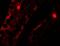Mitochondrial Transcription Termination Factor 4 antibody, A10646, Boster Biological Technology, Immunofluorescence image 