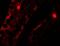 Mitochondrial Transcription Termination Factor 4 antibody, A10646, Boster Biological Technology, Immunofluorescence image 