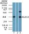 STE20 Related Adaptor Beta antibody, NBP2-24680, Novus Biologicals, Western Blot image 