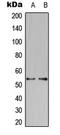 Potassium Voltage-Gated Channel Modifier Subfamily S Member 2 antibody, LS-C354007, Lifespan Biosciences, Western Blot image 