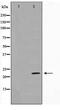 DIRAS Family GTPase 1 antibody, TA347639, Origene, Western Blot image 