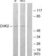 Checkpoint Kinase 2 antibody, LS-B7598, Lifespan Biosciences, Western Blot image 