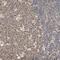 Zinc Finger Matrin-Type 5 antibody, NBP1-85794, Novus Biologicals, Immunohistochemistry paraffin image 