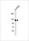 Colony Stimulating Factor 1 Receptor antibody, M00082, Boster Biological Technology, Western Blot image 
