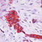 TFF1 antibody, LS-C87929, Lifespan Biosciences, Immunohistochemistry paraffin image 