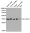 Major Histocompatibility Complex, Class II, DQ Alpha 1 antibody, abx001780, Abbexa, Western Blot image 