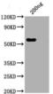 SARS CoV Nucleoprotein antibody, LS-C829130, Lifespan Biosciences, Western Blot image 