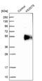 Heparan Sulfate-Glucosamine 3-Sulfotransferase 5 antibody, PA5-54522, Invitrogen Antibodies, Western Blot image 