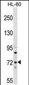 Myotubularin Related Protein 6 antibody, PA5-71949, Invitrogen Antibodies, Western Blot image 