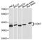 Cyclin Dependent Kinase 7 antibody, A12942, ABclonal Technology, Western Blot image 