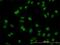 ADP Ribosylation Factor Like GTPase 6 Interacting Protein 4 antibody, H00051329-M09, Novus Biologicals, Immunocytochemistry image 