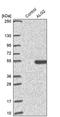 ALG2 Alpha-1,3/1,6-Mannosyltransferase antibody, PA5-59606, Invitrogen Antibodies, Western Blot image 