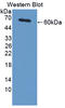 Protein Inhibitor Of Activated STAT 3 antibody, LS-C373272, Lifespan Biosciences, Western Blot image 