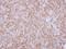 Profilin 1 antibody, PA5-27612, Invitrogen Antibodies, Immunohistochemistry paraffin image 