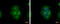S100 Calcium Binding Protein A9 antibody, GTX129575, GeneTex, Immunofluorescence image 