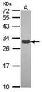 Glutamate-Cysteine Ligase Modifier Subunit antibody, GTX114075, GeneTex, Western Blot image 