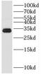 Kallikrein Related Peptidase 3 antibody, FNab04631, FineTest, Western Blot image 