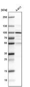Prolyl 3-Hydroxylase 2 antibody, NBP1-94041, Novus Biologicals, Western Blot image 