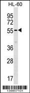 SAMM50 Sorting And Assembly Machinery Component antibody, 60-378, ProSci, Western Blot image 