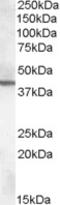 Arginine Vasopressin Receptor 1B antibody, 45-308, ProSci, Enzyme Linked Immunosorbent Assay image 