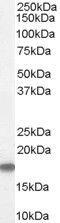 Stathmin 1 antibody, GTX89411, GeneTex, Western Blot image 