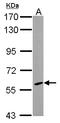 Cholesterol 24-hydroxylase antibody, LS-C155427, Lifespan Biosciences, Western Blot image 