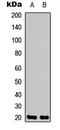 Neuromedin U antibody, LS-C368444, Lifespan Biosciences, Western Blot image 