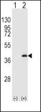 Protein Phosphatase 1 Catalytic Subunit Beta antibody, PA5-15535, Invitrogen Antibodies, Western Blot image 