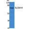 Solute Carrier Family 6 Member 14 antibody, LS-C386860, Lifespan Biosciences, Western Blot image 