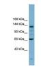 Isoleucyl-TRNA Synthetase antibody, NBP1-55362, Novus Biologicals, Western Blot image 