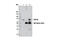 Decapping MRNA 1B antibody, 13233S, Cell Signaling Technology, Immunoprecipitation image 