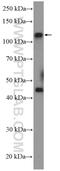 Centrosomal Protein 112 antibody, 24928-1-AP, Proteintech Group, Western Blot image 