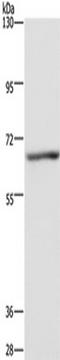 Potassium Voltage-Gated Channel Subfamily D Member 1 antibody, TA351313, Origene, Western Blot image 