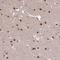 Suppression Of Tumorigenicity 5 antibody, NBP2-13391, Novus Biologicals, Immunohistochemistry frozen image 