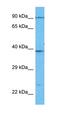 Plasminogen antibody, orb325672, Biorbyt, Western Blot image 