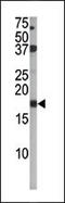 Cyclin-dependent kinase inhibitor 2A, isoforms 1/2/3 antibody, MBS9202994, MyBioSource, Western Blot image 