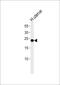 Claudin 6 antibody, PA5-72399, Invitrogen Antibodies, Western Blot image 
