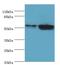 Keratin 8 antibody, LS-C370742, Lifespan Biosciences, Western Blot image 