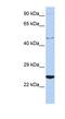Cytokine Receptor Like Factor 1 antibody, NBP1-58328, Novus Biologicals, Western Blot image 