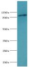 Minichromosome Maintenance Complex Component 6 antibody, LS-C377439, Lifespan Biosciences, Western Blot image 