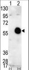 AKT Serine/Threonine Kinase 2 antibody, LS-C98940, Lifespan Biosciences, Western Blot image 