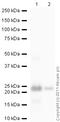 Ferritin Heavy Chain 1 antibody, ab65080, Abcam, Western Blot image 